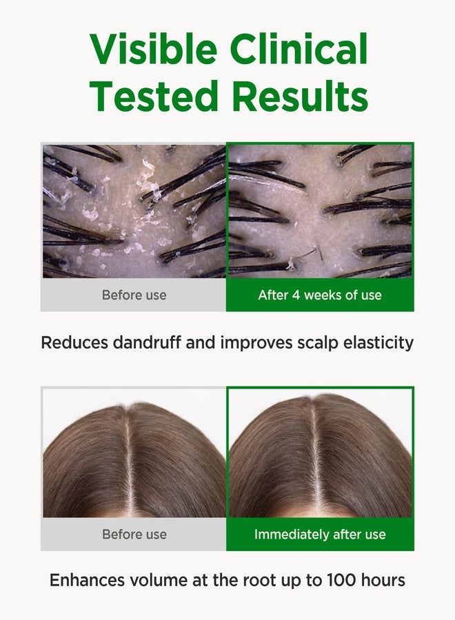 CKD Guaranteed CKD Amino Biotin All powerful Treatment (5.07 fl.oz) - Deep Care Conditioner and Silicone-Free Treatment, Prevents Damaged Hair, Nourishihes Hair, Non-Silicone with Biotin, Amino Acids, and Keratin. - Image 4